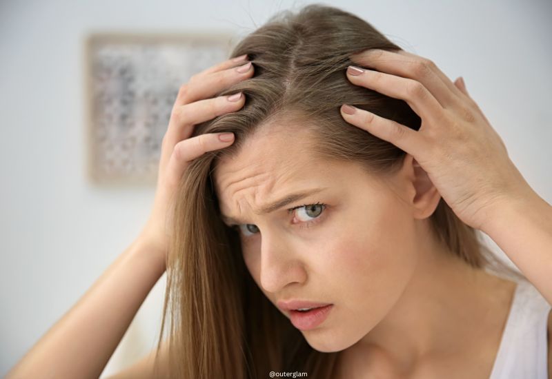 How to Hide Hair Loss in Women: Discreet Solutions and Ideas