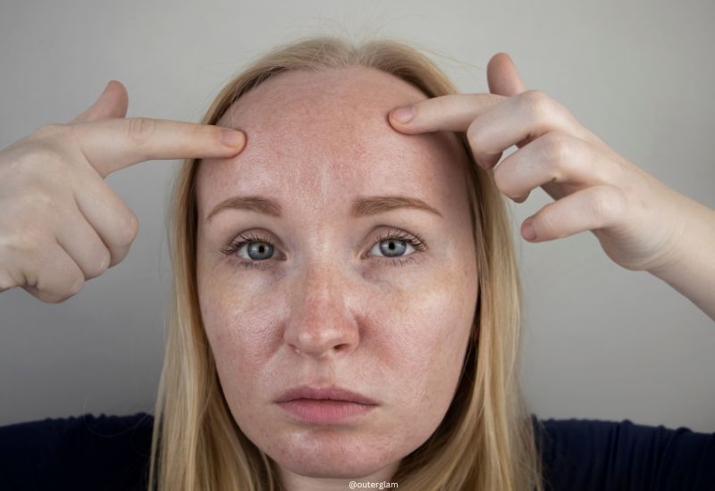 Woman Touching Her Oily Face